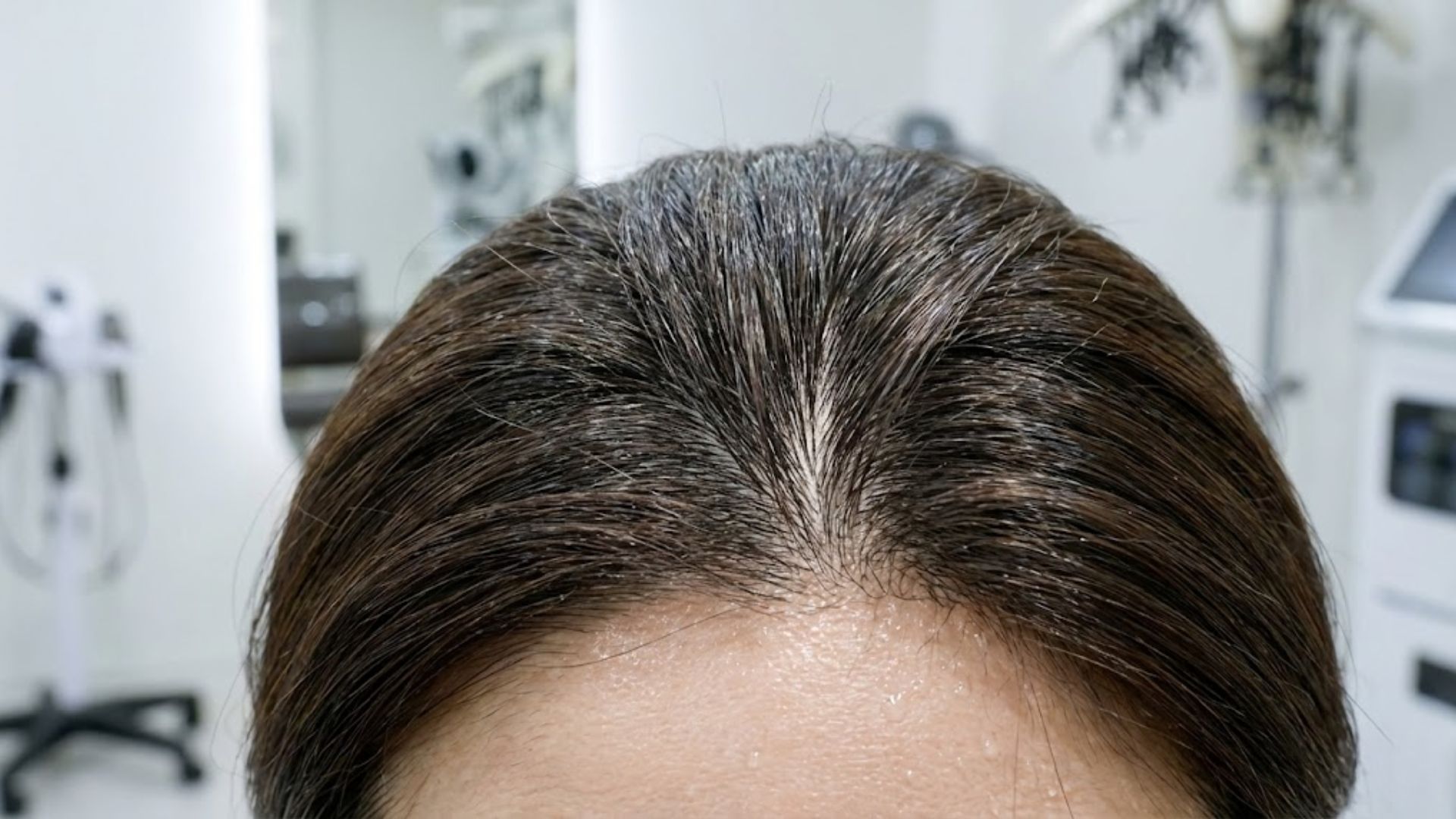 헤드스파 관리 후 깨끗해진 두피 모공과 건강하게 살아난 모발 뿌리의 클로즈업