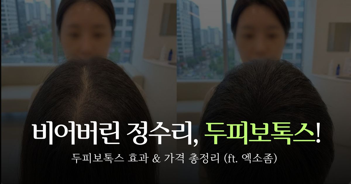 scalp-botox-injection-effect-price-thumbnail