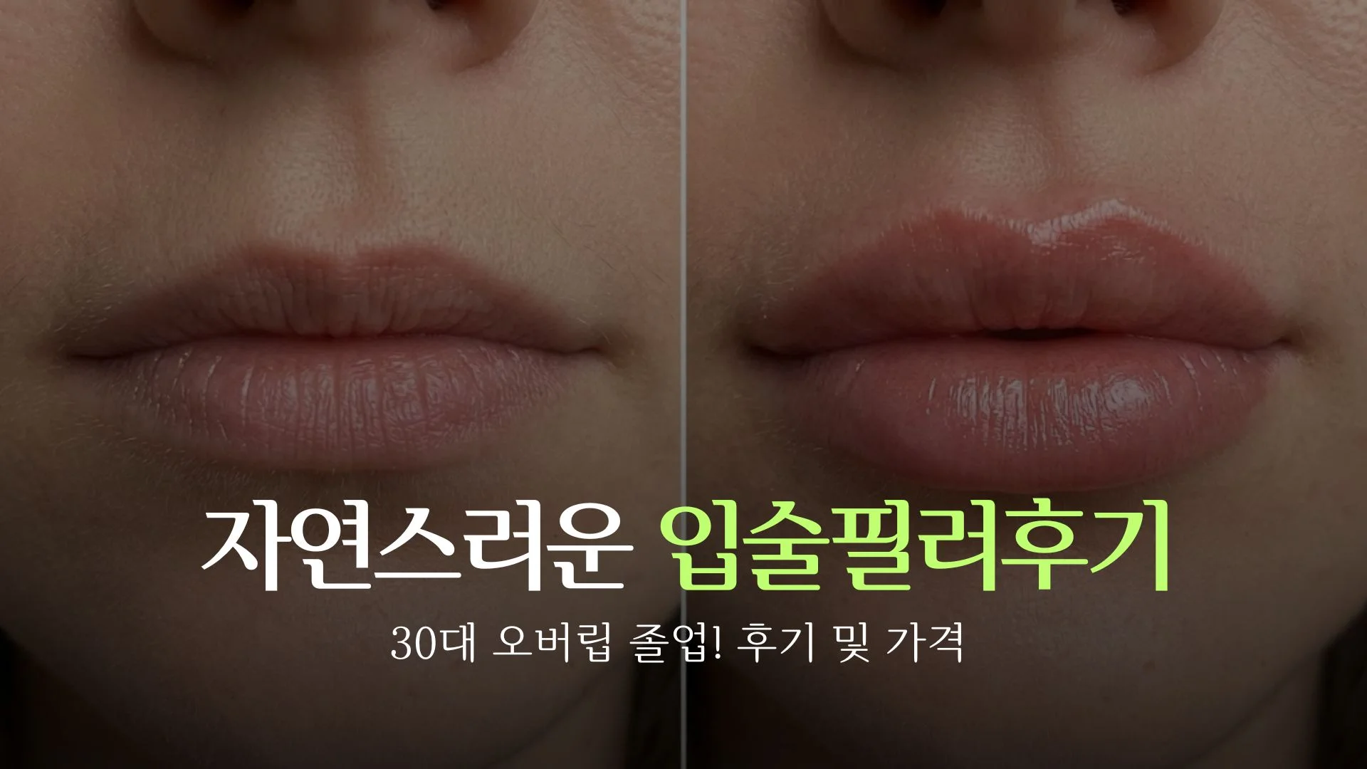 best-natural-lip-filler-review-thumbnail.webp