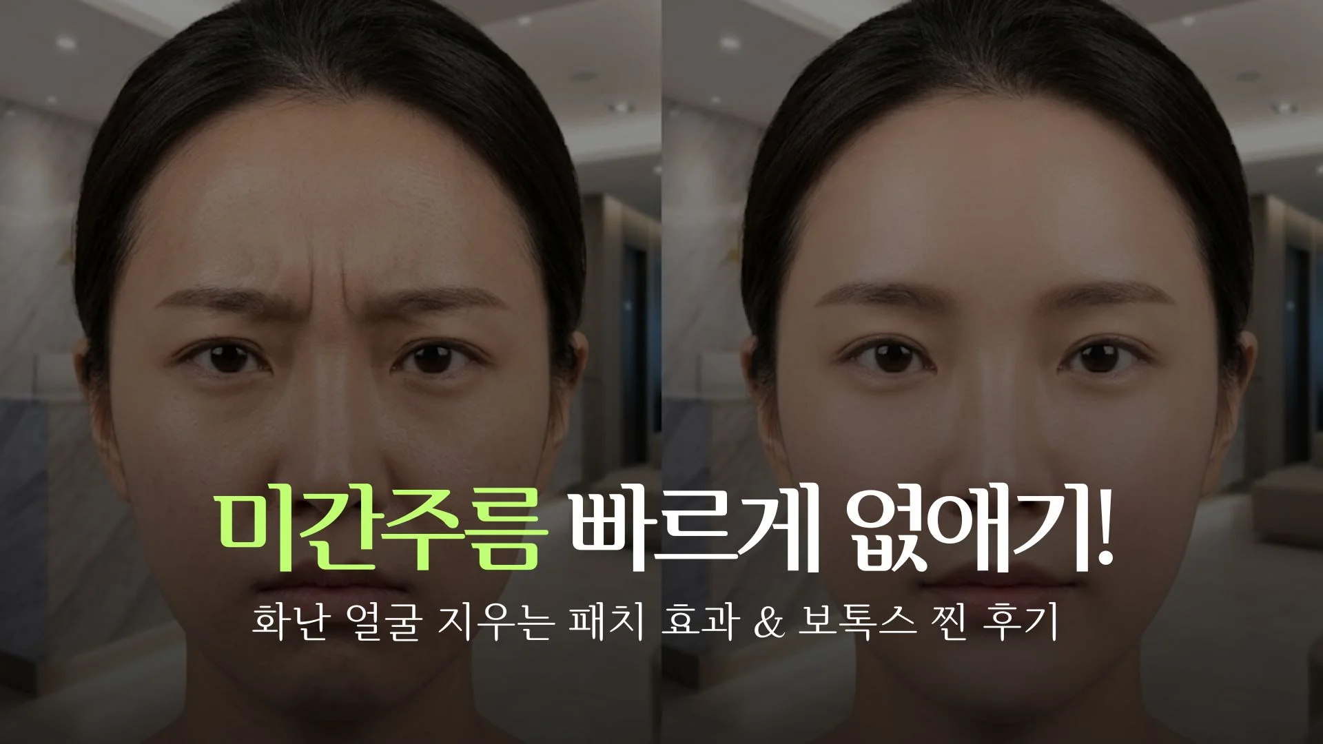 frown-line-patch-vs-botox-thumbnail.webp